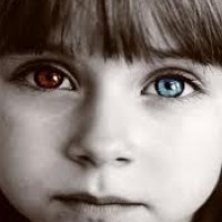Blauw en bruin oog Heterochromia: blauw en bruin oog