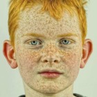 Engelse met sproeten Sproeten.jongen